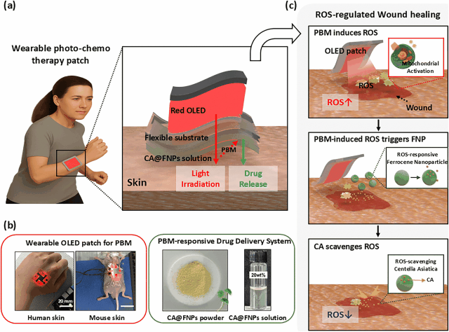 S. Korean researchers develop smart OLED patch to accelerate wound healing speed