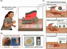 S. Korean researchers develop smart OLED patch to accelerate wound healing speed