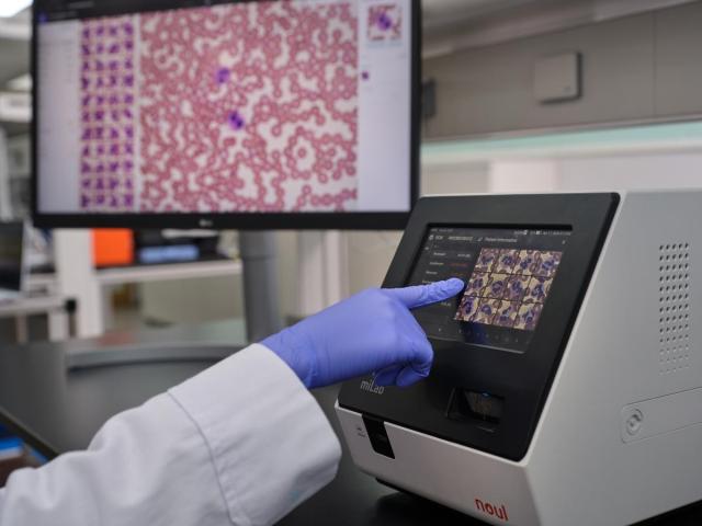 Ảnh nghiên cứu giải pháp phân tích máu miLab BCM của Noeul
Cung cấp bởi Noeul