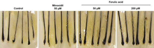 LG생활건강, 천궁 유래 페룰릭산-NMN 조합 모발 성장 효과 입증