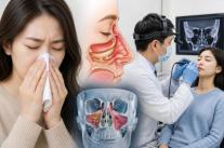 Chảy nước mũi, nghẹt mũi chưa chắc chỉ là viêm mũi dị ứng… Lạm dụng thuốc có thể khiến bệnh nặng hơn