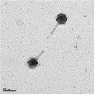 Hàn Quốc phát hiện virus có thể tiêu diệt vi khuẩn kháng nhiều loại kháng sinh