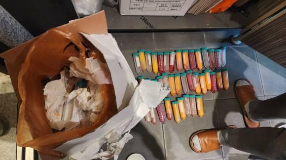 시험관에 담긴 폐지방 혈액 등 조직물류폐기물을 일반의료폐기물에 섞어 상온에 보관하다 적발된 모습 사진서울시