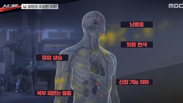 사진MBC 스트레이트 방송 캡처